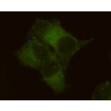Immunocytochemistry - Placental alkaline phosphatase (PLAP) Monoclonal Antibody from Signalway Antibody (27192)