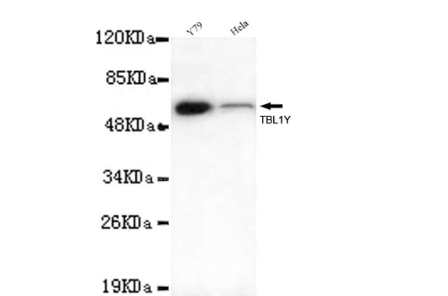 TBL1Y Monoclonal Antibody from Signalway Antibody (27006) - Antibodies.com