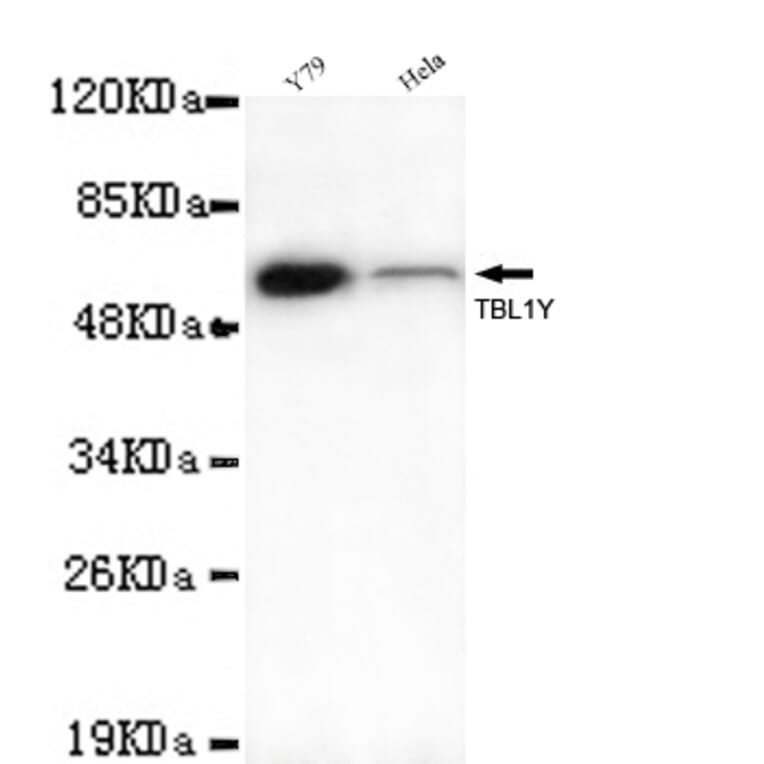 TBL1Y Monoclonal Antibody from Signalway Antibody (27006) - Antibodies.com