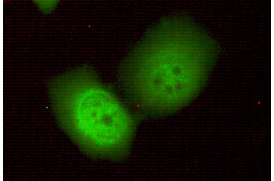 TBL1Y Monoclonal Antibody from Signalway Antibody (27006) - Antibodies.com