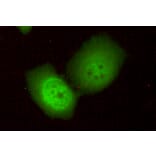 TBL1Y Monoclonal Antibody from Signalway Antibody (27006) - Antibodies.com