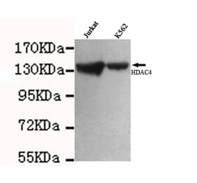 HDAC4 Monoclonal Antibody from Signalway Antibody (27009) - Antibodies.com