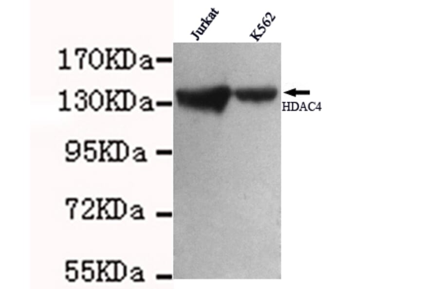 HDAC4 Monoclonal Antibody from Signalway Antibody (27009) - Antibodies.com