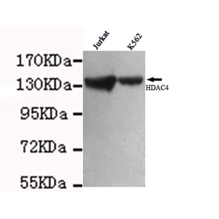HDAC4 Monoclonal Antibody from Signalway Antibody (27009) - Antibodies.com