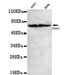 FOXO1 Monoclonal Antibody from Signalway Antibody (27063) - Antibodies.com