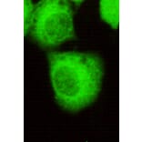 FOXO1 Monoclonal Antibody from Signalway Antibody (27063) - Antibodies.com