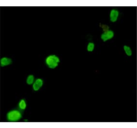 Immunocytochemistry - FOXP3 Monoclonal Antibody from Signalway Antibody (27179) - Antibodies.com