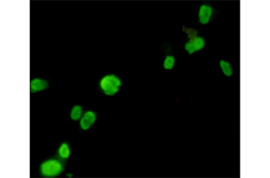 Immunocytochemistry - FOXP3 Monoclonal Antibody from Signalway Antibody (27179) - Antibodies.com