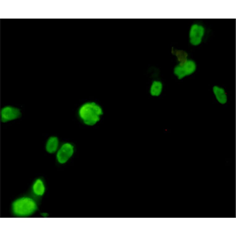 Immunocytochemistry - FOXP3 Monoclonal Antibody from Signalway Antibody (27179) - Antibodies.com