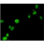 Immunocytochemistry - FOXP3 Monoclonal Antibody from Signalway Antibody (27179) - Antibodies.com
