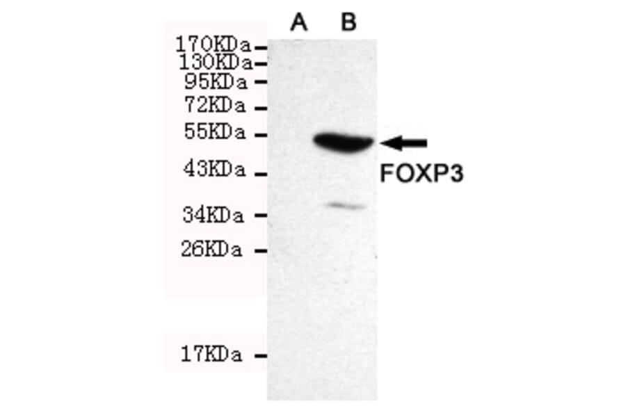 Western blot - FOXP3 Monoclonal Antibody from Signalway Antibody (27179) - Antibodies.com