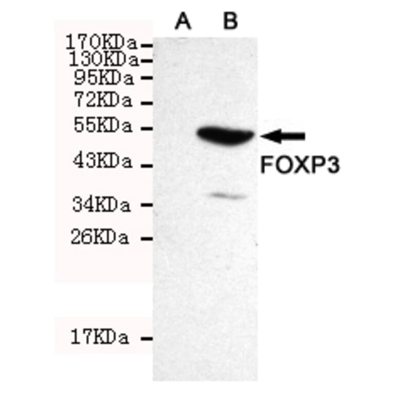 Western blot - FOXP3 Monoclonal Antibody from Signalway Antibody (27179) - Antibodies.com
