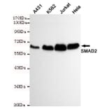 Western blot - Smad2 Monoclonal Antibody from Signalway Antibody (27195) - Antibodies.com