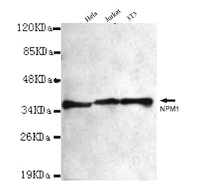 NPM1 Monoclonal Antibody from Signalway Antibody (27013) - Antibodies.com