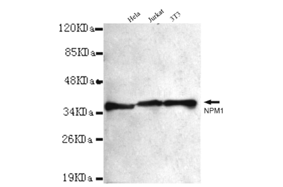NPM1 Monoclonal Antibody from Signalway Antibody (27013) - Antibodies.com