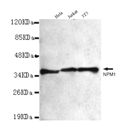 NPM1 Monoclonal Antibody from Signalway Antibody (27013) - Antibodies.com