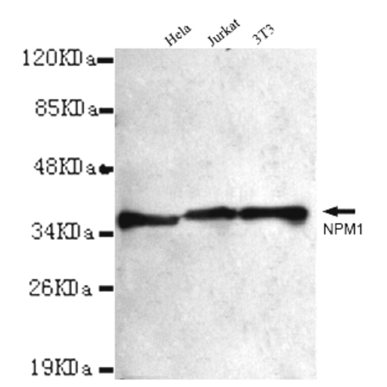 NPM1 Monoclonal Antibody from Signalway Antibody (27013) - Antibodies.com