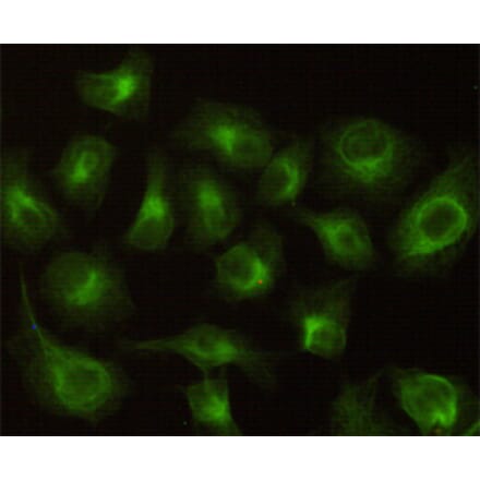 Immunocytochemistry - CBR1 Monoclonal Antibody from Signalway Antibody (27187) - Antibodies.com