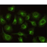 Immunocytochemistry - CBR1 Monoclonal Antibody from Signalway Antibody (27187) - Antibodies.com