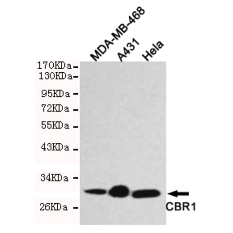 Western blot - CBR1 Monoclonal Antibody from Signalway Antibody (27187) - Antibodies.com