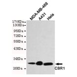Western blot - CBR1 Monoclonal Antibody from Signalway Antibody (27187) - Antibodies.com