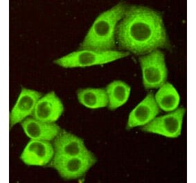 Immunocytochemistry - DR5 Monoclonal Antibody from Signalway Antibody (27200) - Antibodies.com