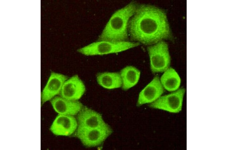 Immunocytochemistry - DR5 Monoclonal Antibody from Signalway Antibody (27200) - Antibodies.com