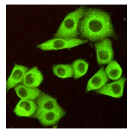 Immunocytochemistry - DR5 Monoclonal Antibody from Signalway Antibody (27200) - Antibodies.com