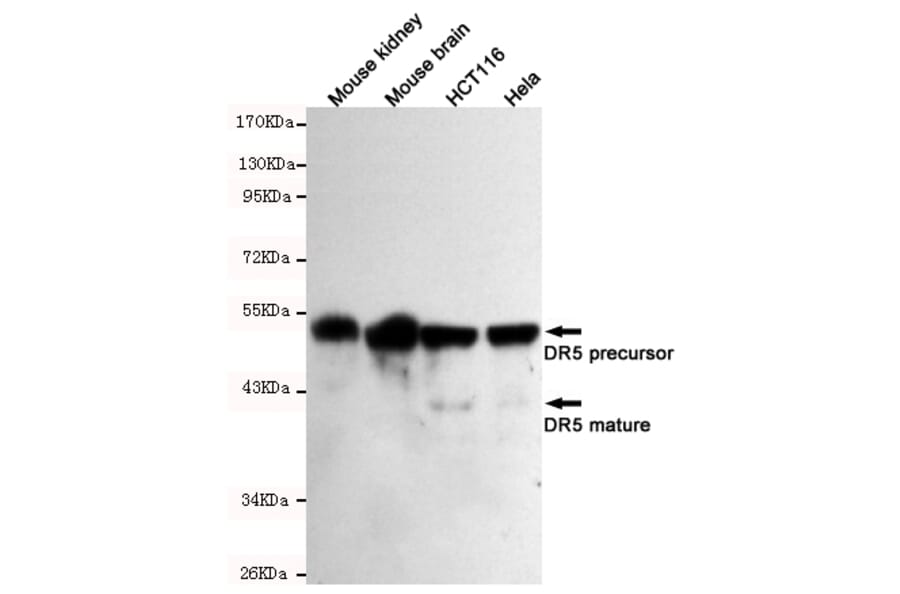 Western blot - DR5 Monoclonal Antibody from Signalway Antibody (27200) - Antibodies.com
