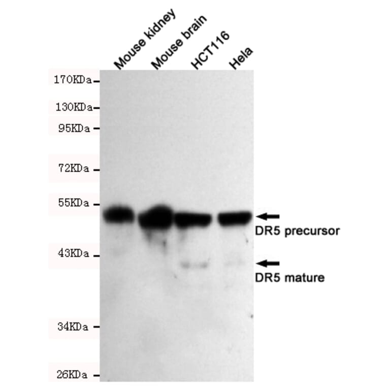 Western blot - DR5 Monoclonal Antibody from Signalway Antibody (27200) - Antibodies.com