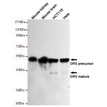 Western blot - DR5 Monoclonal Antibody from Signalway Antibody (27200) - Antibodies.com