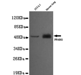 PPAR gamma (C-term) Monoclonal Antibody from Signalway Antibody (27024) - Antibodies.com