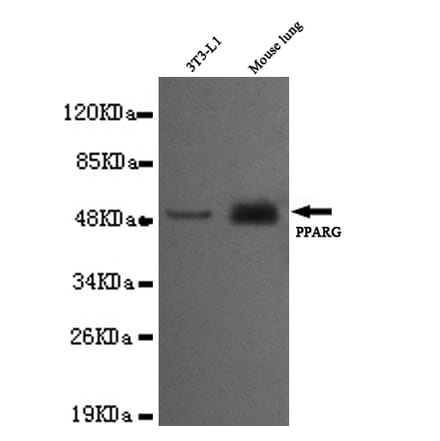 PPAR gamma (C-term) Monoclonal Antibody from Signalway Antibody (27024) - Antibodies.com