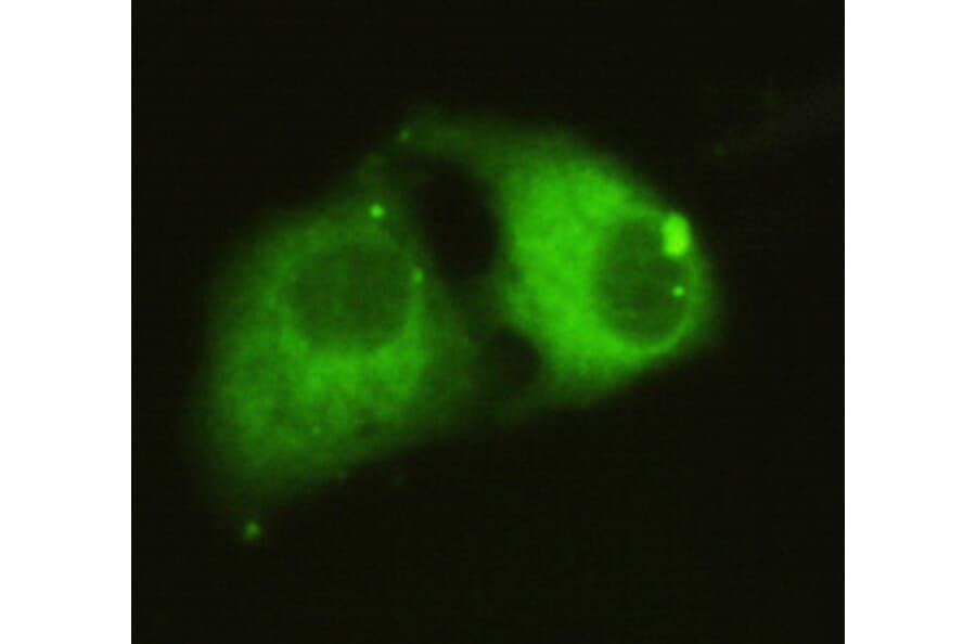 PPAR gamma (C-term) Monoclonal Antibody from Signalway Antibody (27024) - Antibodies.com