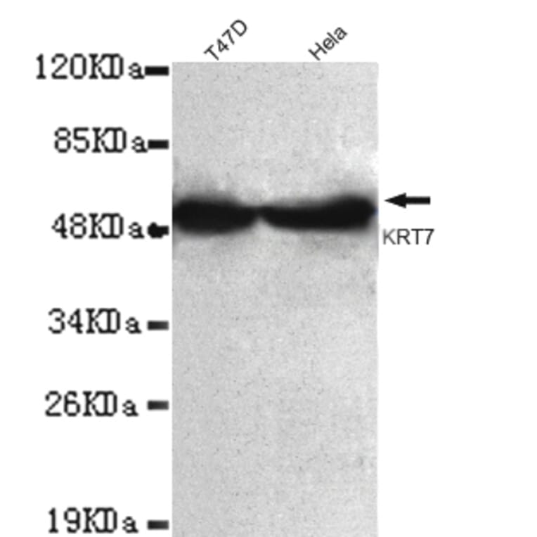 Keratin 7 (C-term) Monoclonal Antibody from Signalway Antibody (27028) - Antibodies.com