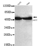 Keratin 7 (C-term) Monoclonal Antibody from Signalway Antibody (27028) - Antibodies.com