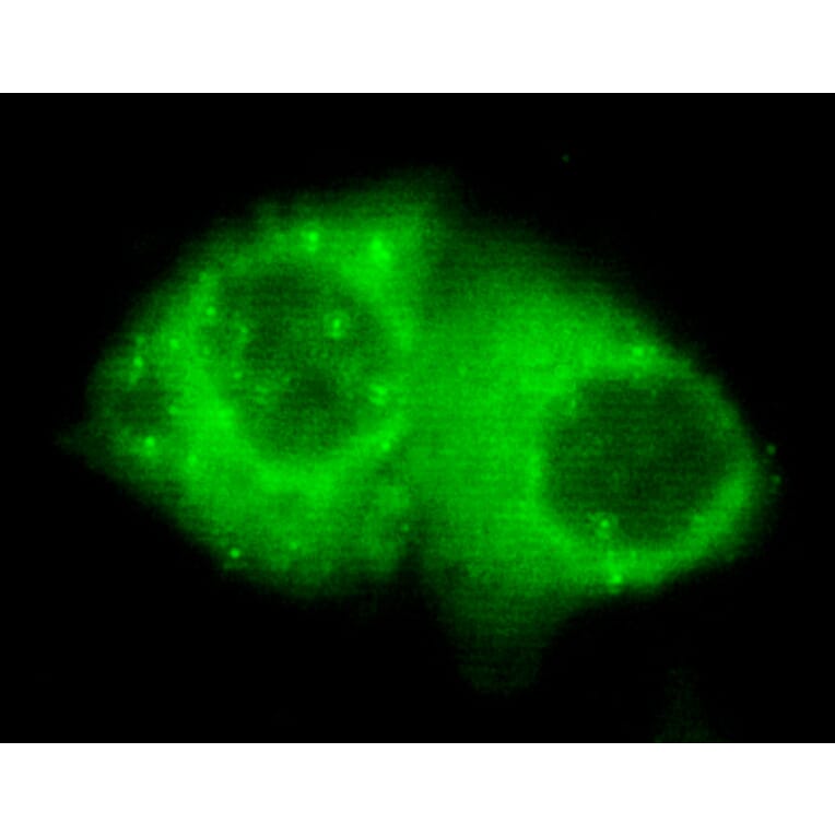 Keratin 7 (C-term) Monoclonal Antibody from Signalway Antibody (27028) - Antibodies.com