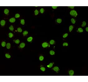 Immunocytochemistry - CHD3 (C-terminus) Monoclonal Antibody from Signalway Antibody (27173) - Antibodies.com