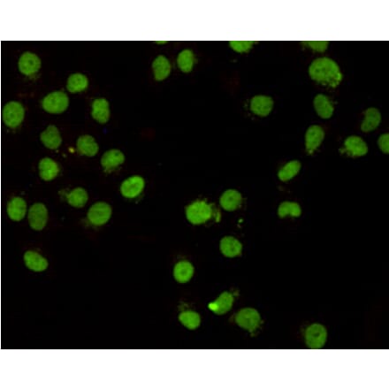 Immunocytochemistry - CHD3 (C-terminus) Monoclonal Antibody from Signalway Antibody (27173) - Antibodies.com