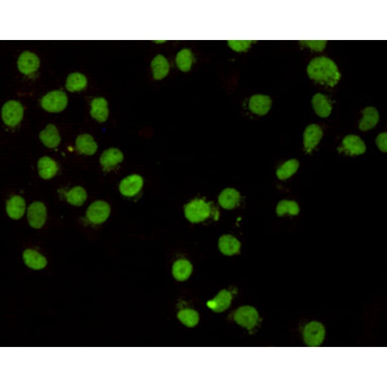 Immunocytochemistry - CHD3 (C-terminus) Monoclonal Antibody from Signalway Antibody (27173) - Antibodies.com