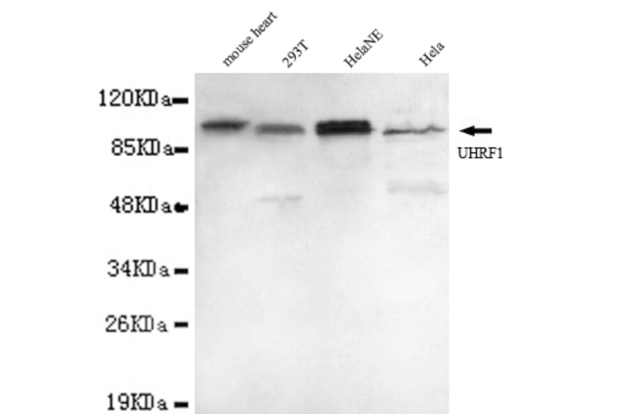 UHRF1 (N-term) Monoclonal Antibody from Signalway Antibody (27003) - Antibodies.com