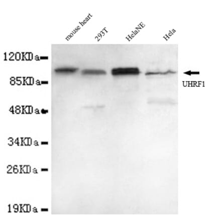 UHRF1 (N-term) Monoclonal Antibody from Signalway Antibody (27003) - Antibodies.com