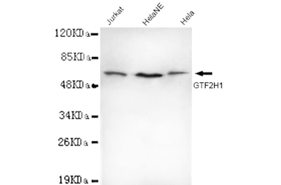 TFIIH (N-term) Monoclonal Antibody from Signalway Antibody (27053) - Antibodies.com