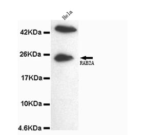 Rab2A (C-term) Monoclonal Antibody from Signalway Antibody (27064) - Antibodies.com