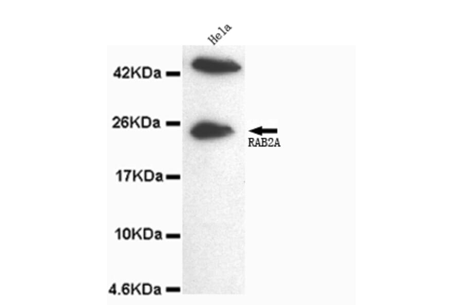 Rab2A (C-term) Monoclonal Antibody from Signalway Antibody (27064) - Antibodies.com