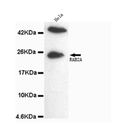 Rab2A (C-term) Monoclonal Antibody from Signalway Antibody (27064) - Antibodies.com