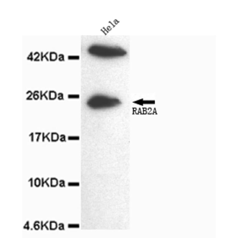 Rab2A (C-term) Monoclonal Antibody from Signalway Antibody (27064) - Antibodies.com