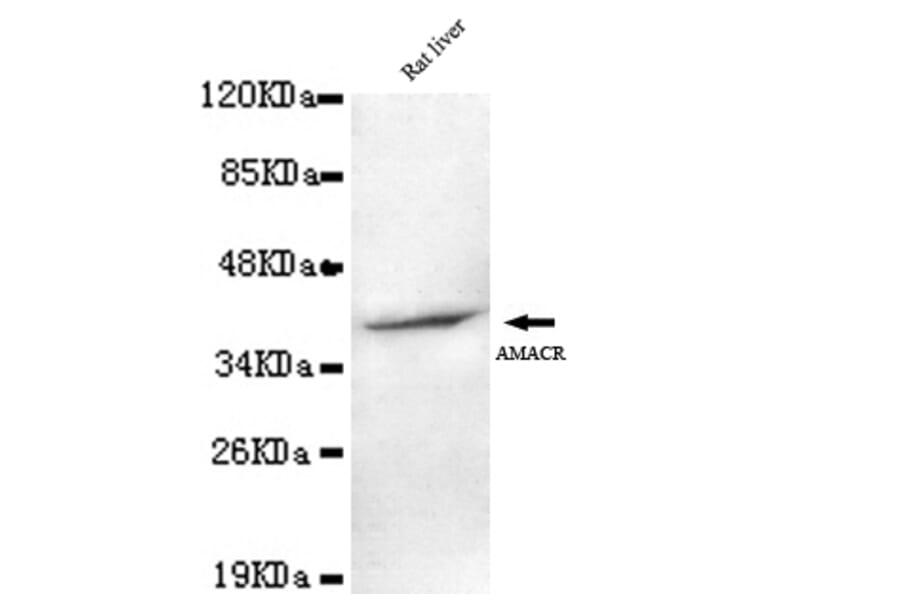 AMACR (C-term) Monoclonal Antibody from Signalway Antibody (27068) - Antibodies.com