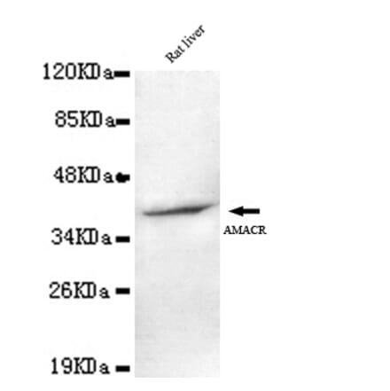 AMACR (C-term) Monoclonal Antibody from Signalway Antibody (27068) - Antibodies.com