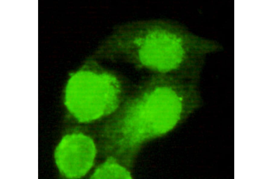 AMACR (C-term) Monoclonal Antibody from Signalway Antibody (27068) - Antibodies.com